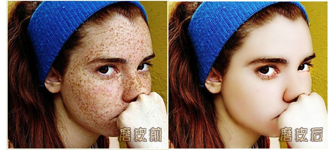 <em>女孩去斑</em>案例图片+-+设计师qinpinhua2008设计