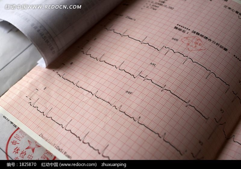 心电图高清图片下载_红动中国