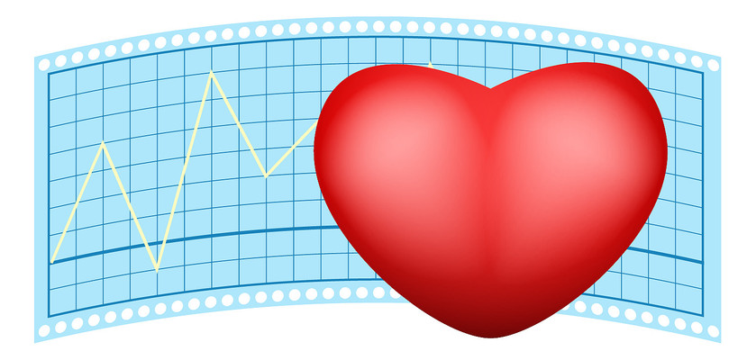 手绘卡通心电图 手绘卡通心电图