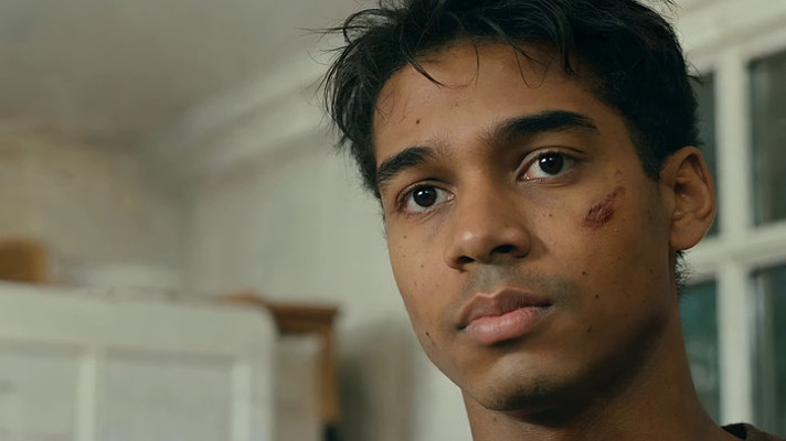 面部有伤的年轻男子特写