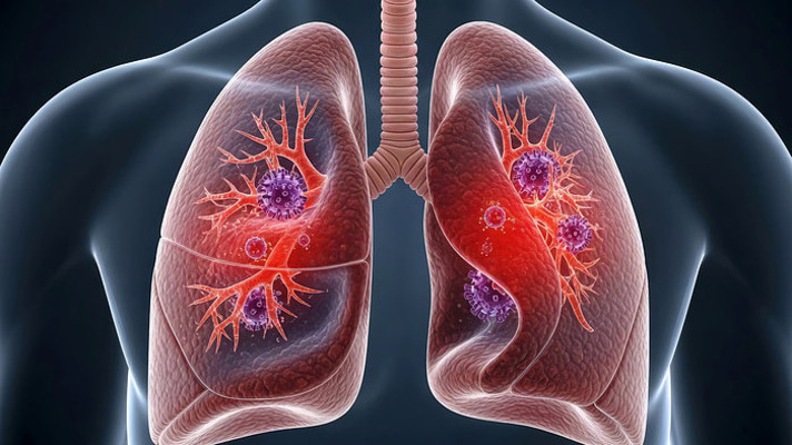 肺部感染病毒3D展示 肺部感染病毒3D展示