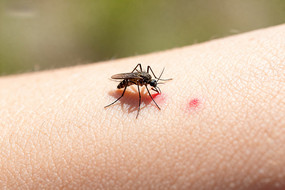 ���Ӷ�ҧƤ������д��ͷ