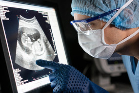 ҽ��ͨ��X��Ƭ�������