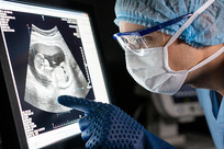 ҽ��ͨ��X��Ƭ�������