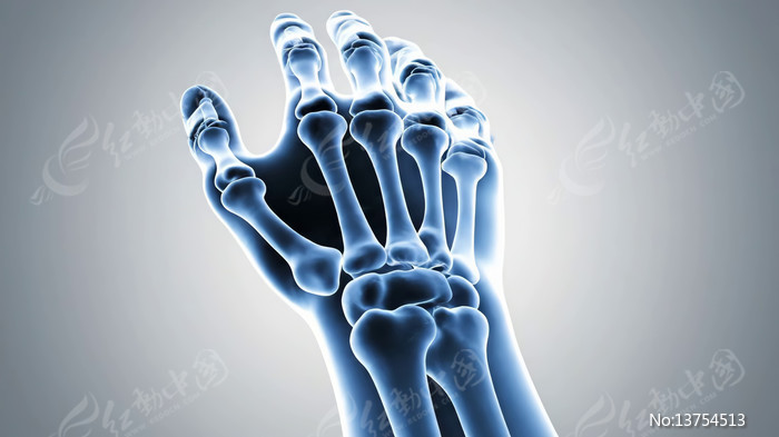 3D�ֲ�����X�⶯��