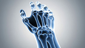 3D�ֲ�����X�⶯��