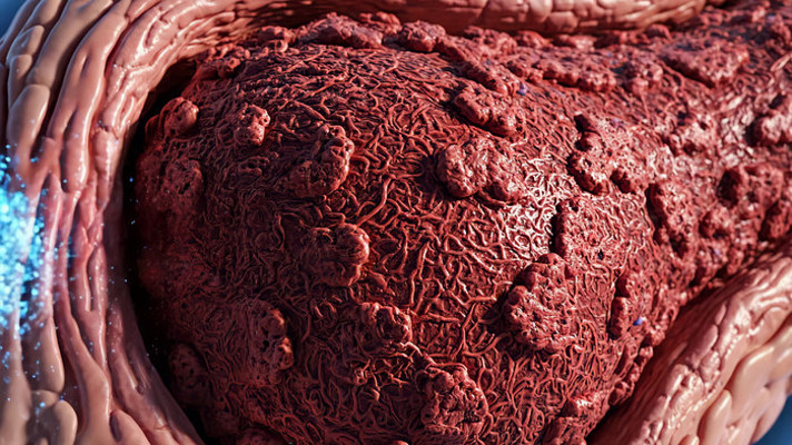 3D 膝关节细胞修复过程动画 3D 膝关节细胞修复过程动画