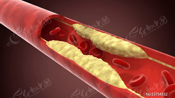 3DѪ�ܶ���������ʾ