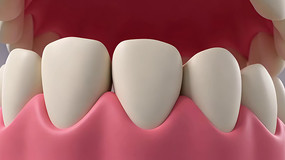 3D����ģ�Ͷ���