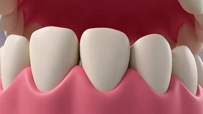 3D����ģ�Ͷ���