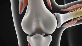 ������ؽ�ҽѧչʾ