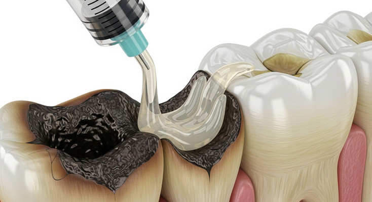 ȣ���޸���������