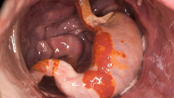 人体胃部内部结构动画 人体胃部内部结构动画