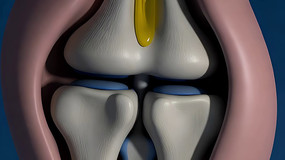 ϥ�ؽ�3Dҽѧģ��չʾ