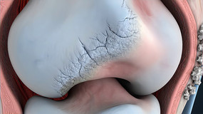 ϥ�ؽڲ���3D��ʾ