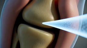 ϥ�ؽ�ҽѧ����3Dչʾ�ز�