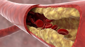 ѪҺ������Ѫ�ܶ�����ʾ