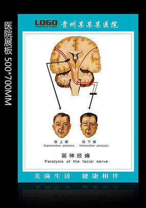 核上瘫和核下瘫区别图片