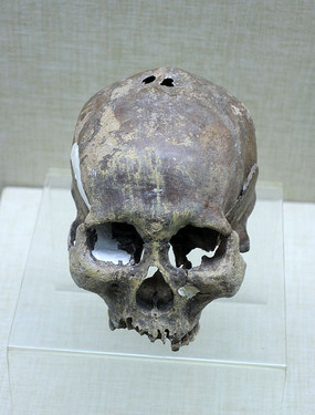 ����ŵ��ͷ��