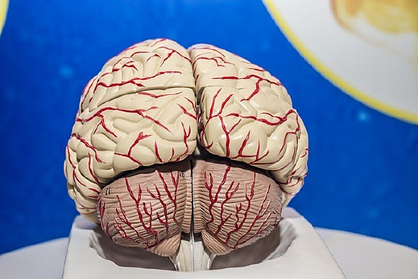 �������ģ��