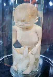 �����߸��µ�̥���걾