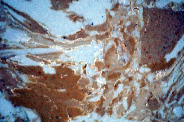 ��ɫ����ͼ������