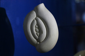 �������ĳ� ����