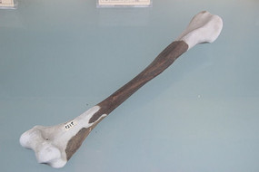 ����ֱ���˱۹ǻ�ʯ