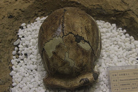 ����ֱ��������ͷ�ǹǻ�ʯ