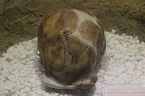 ����ֱ����Ů��ͷ�ǹǻ�ʯ